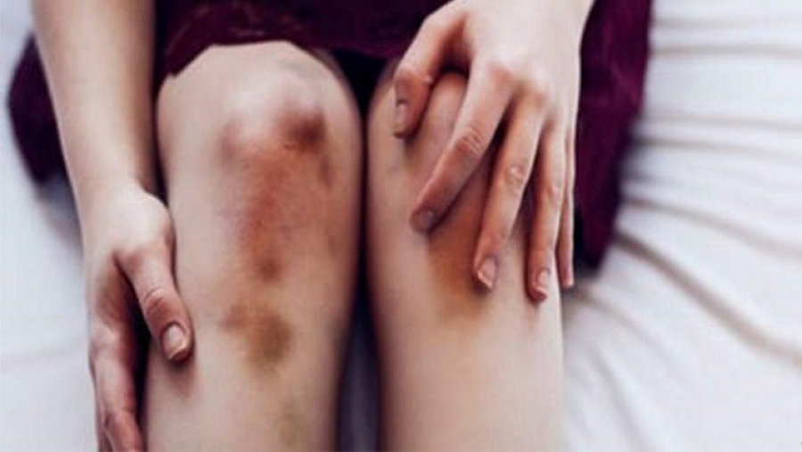 В Костромской области неудавшегося насильника девочки-подростка отправили на принудительное лечение