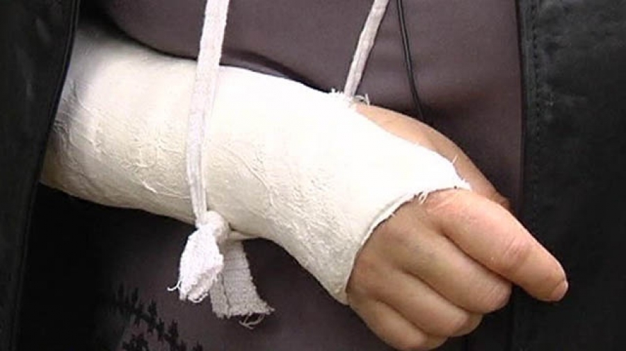 В Костроме турист сломал руку в поисках туалета