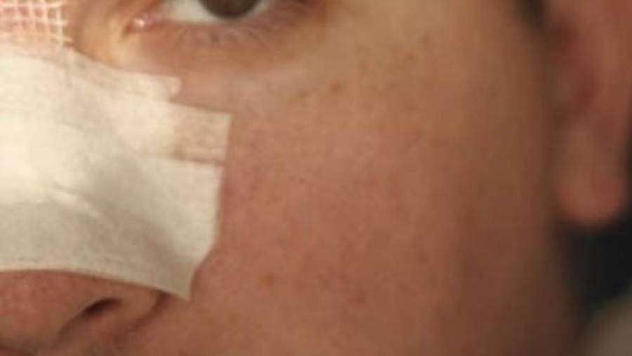 Костромича осудили за сломанный нос полицейского