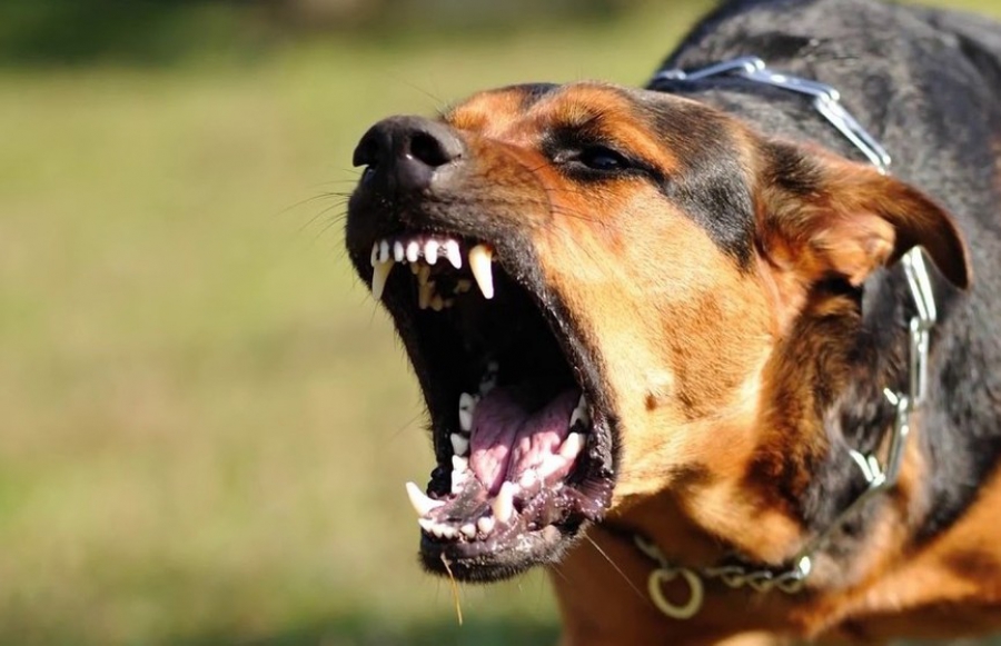 В Костроме агрессивная собака сильно покусала ребенка