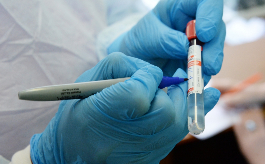 В Костроме зарегистрировано уже 15 случаев коронавируса