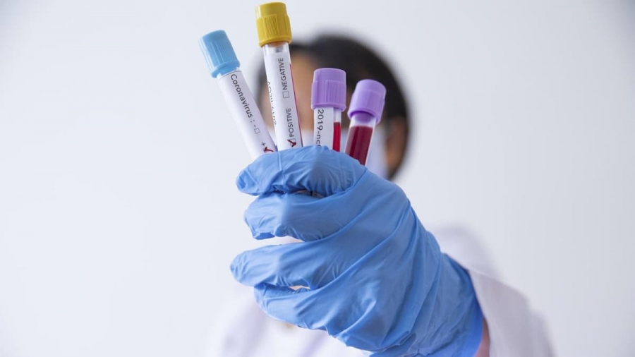 За два месяца почти три тысячи костромичей сдали платные тесты на коронавирус