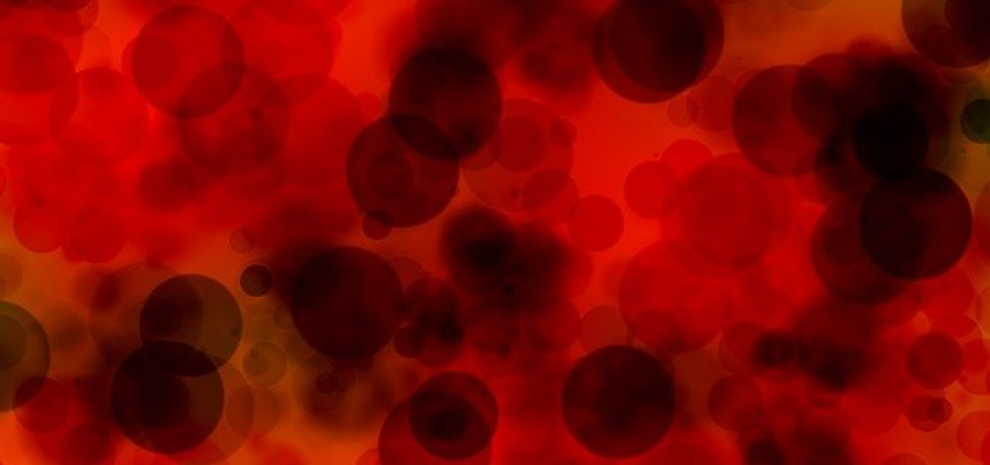 Костромичу с онкологией необходим донор крови