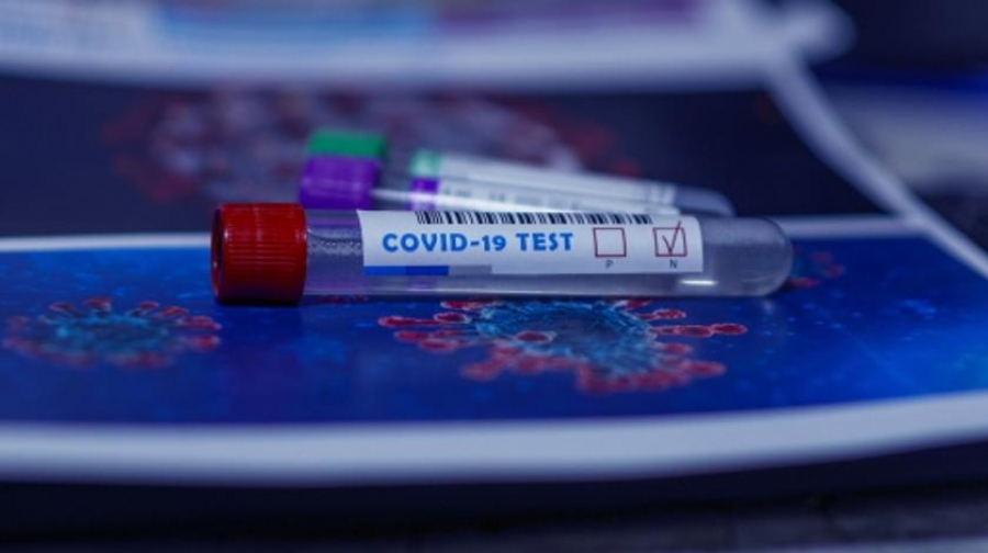 В Костромской области ежедневно снижается количество заболевших коронавирусом