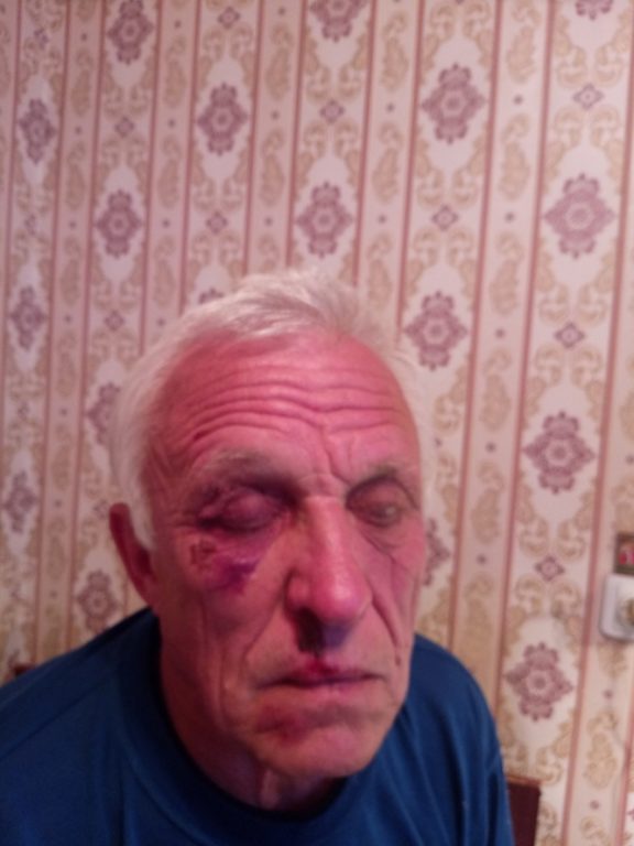 Родственники избитого накануне Дня ВДВ костромского пенсионера не хотят обращаться в полицию