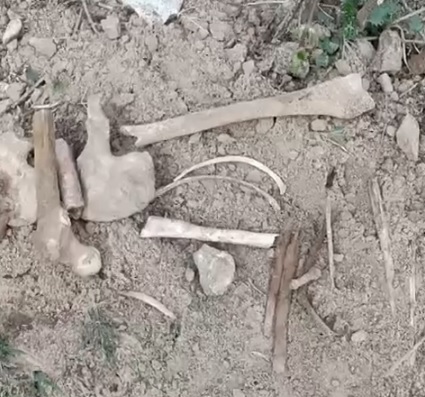 На детской площадке в Костроме нашли похожие на человеческие останки
